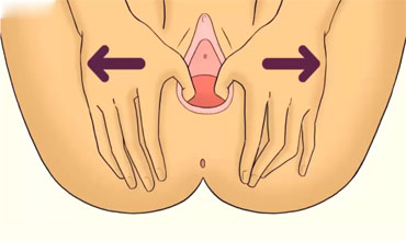 Perineal massage